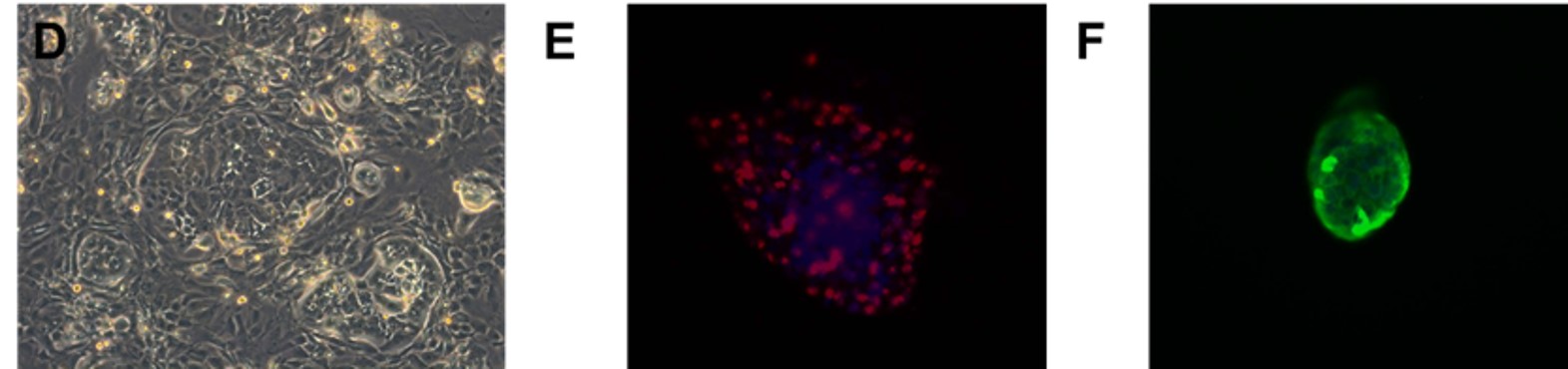 Fig. Morphology of EGFR 19del/T790M /C797S PDX derived cell line (D); Ki67 (E) and Pan-CK (F) staining of 19del/T790M /C797S PDX matching cell derived tumor sphere