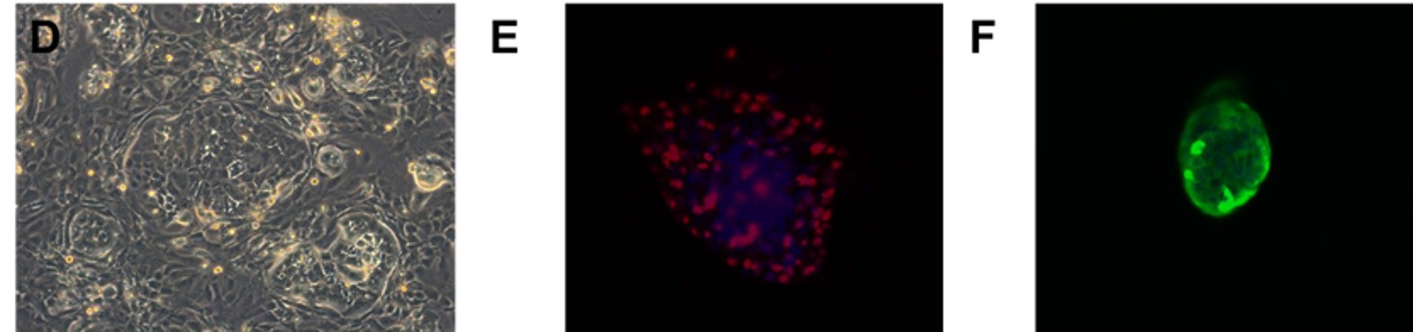 Fig. Morphology of EGFR 19del/T790M /C797S PDX derived cell line (D); Ki67 (E) and Pan-CK (F) staining of 19del/T790M /C797S PDX matching cell derived tumor sphere