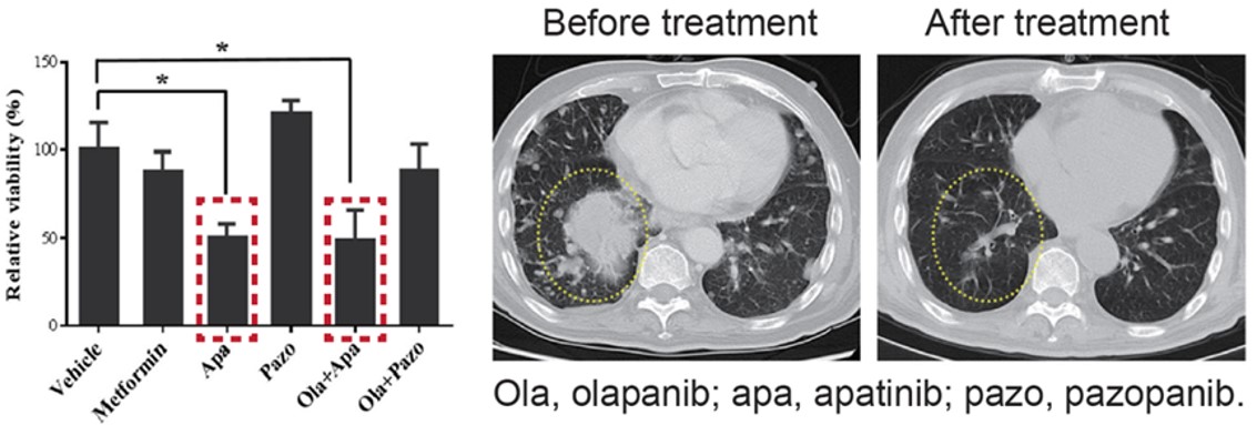 Fig. Positive responses identified with MiniPDX and treatment have resulted in significant reduction in metastasized nodules.